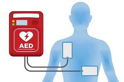 AED Registry Alberta Public Access to Defibrillation PAD Program
